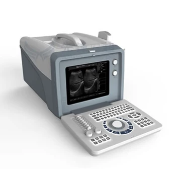 Индивидуальный дизайн XF218, полностью цифровая портативная машина, беспроводной ультразвуковой сканер плода